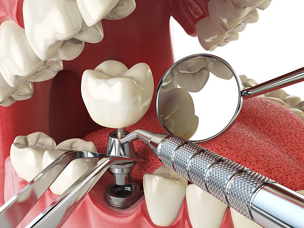 Best Emergency Treatment for Oral Infections in , NY