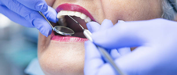 Best Knocked-Out Tooth (Avulsed Tooth) Treatment in , NY